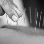 Affordable Acupuncture Elsternwick for Holistic Care
