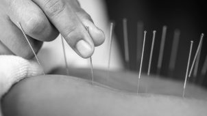 Acupuncture Elsternwick
