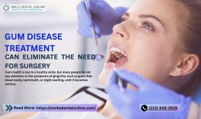 Gum Disease Treatment Can Eliminate the Need for Surgery
