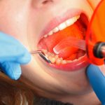 Dental Fillings Fairless Hills PA | Repair Cavities & Protect Your Smile