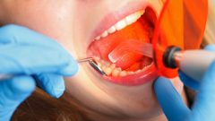 Dental Fillings Fairless Hills PA | Repair Cavities & Protect Your Smile