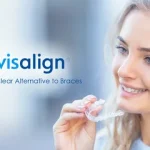 Experience the Magic of Invisalign with Los Angeles Top Dental Experts